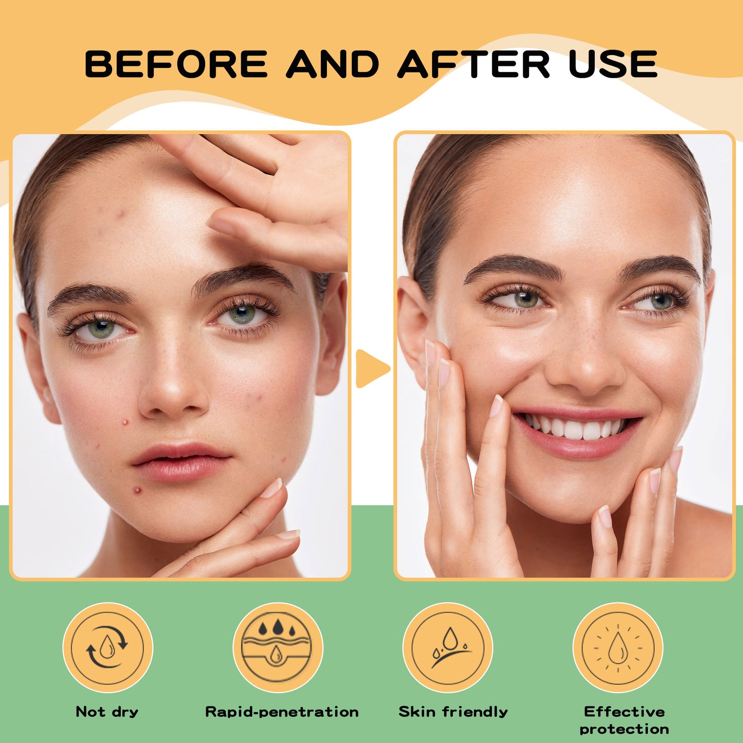 288pcs Hydrocolloid Acne Pimple Patches